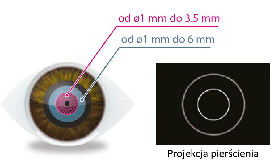 Large-Pupil-Zone_PL_900x529.jpg