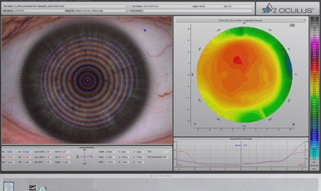 keratograph5m_ophthalmictable_77000_201812_01.jpg